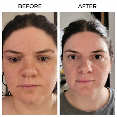 Super C Penetrating Serum
