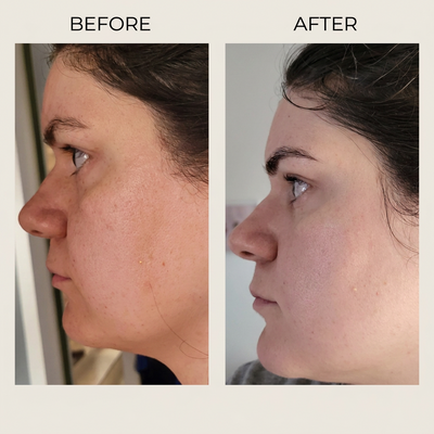 Super C Penetrating Serum