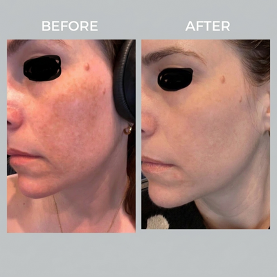 Super C Penetrating Serum